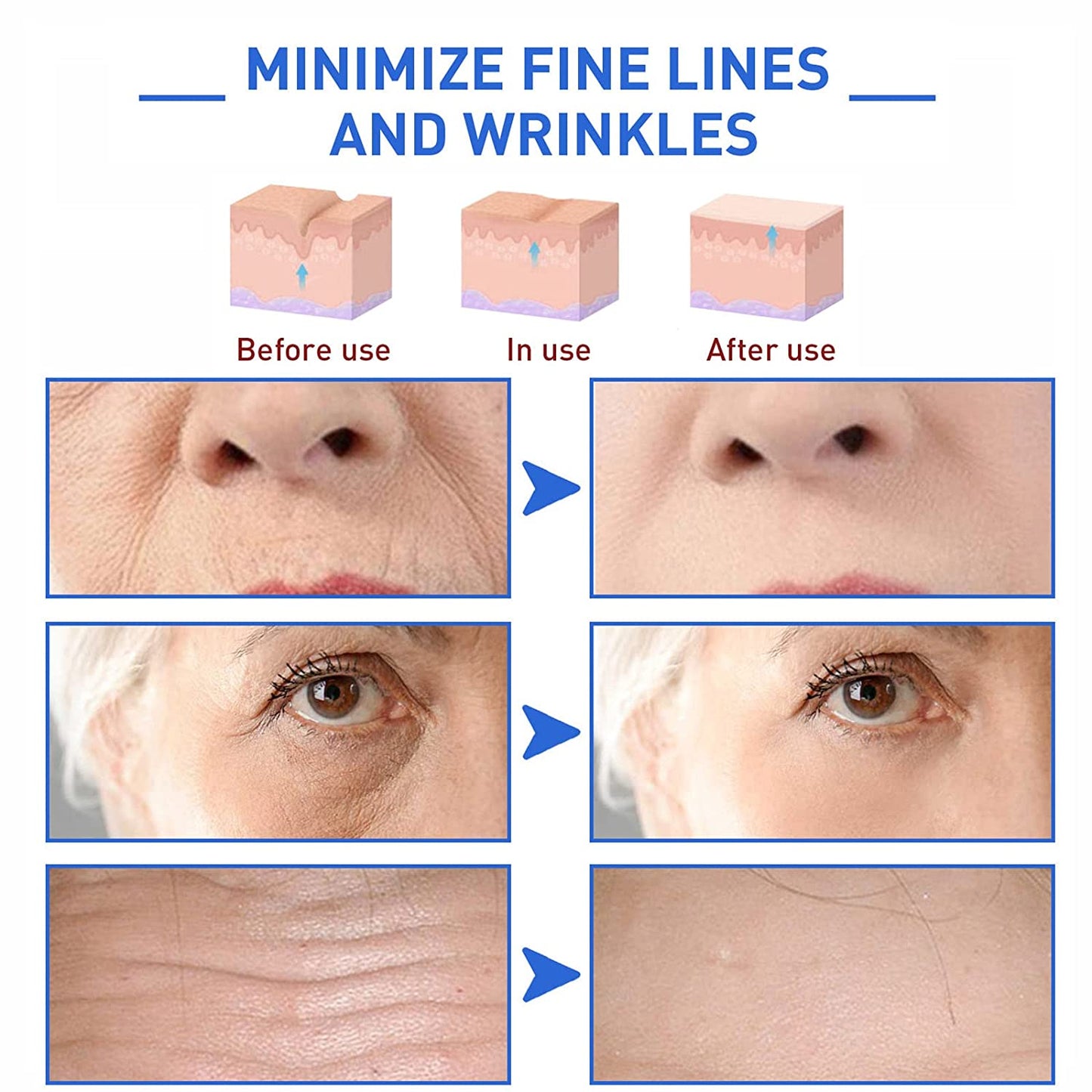 flysmus™ BotoxLUX Anti-Aging Serum