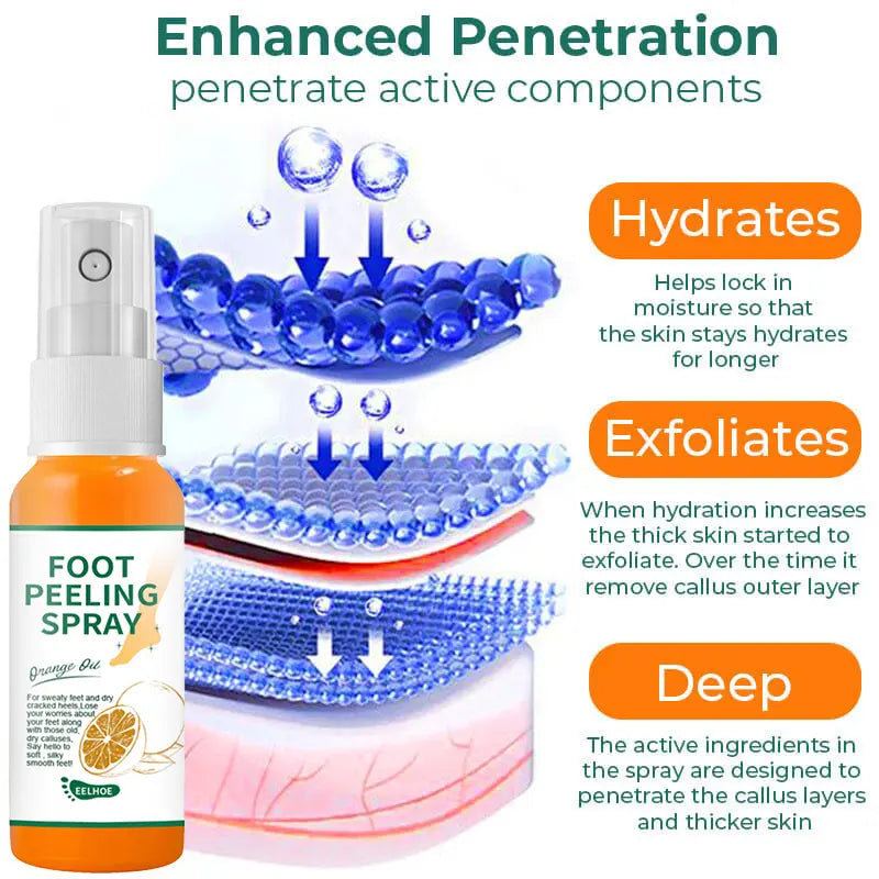 Foot Callus Removal Spray