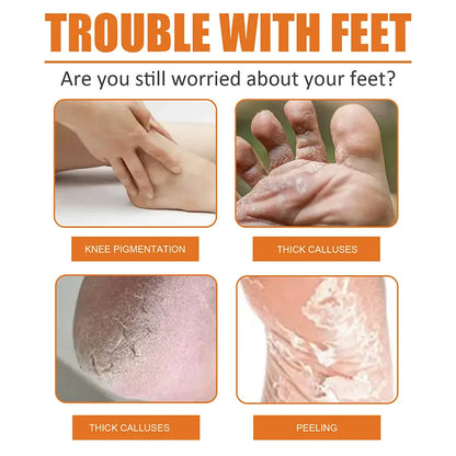 Foot Callus Removal Spray