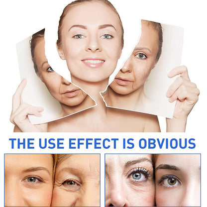 flysmus™ BotoxLUX Anti-Aging Serum