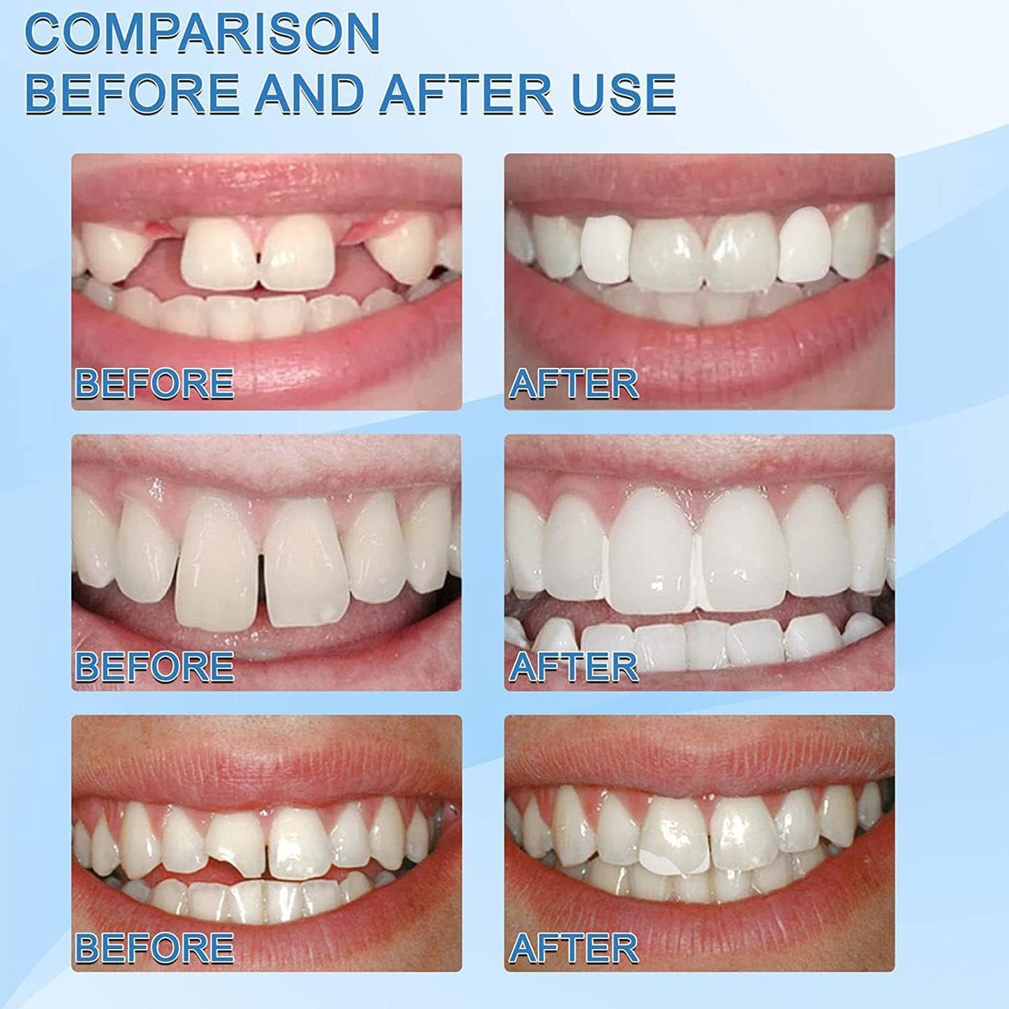 Teeth Repair Granules