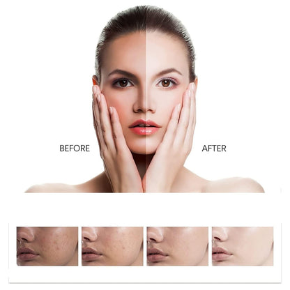 ❤️Imported Southern Xiehe Whitening Facial Cleanser - 🔥For Both Men & Women🔥