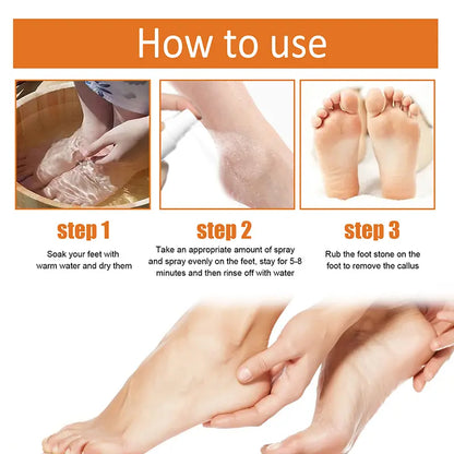 Foot Callus Removal Spray